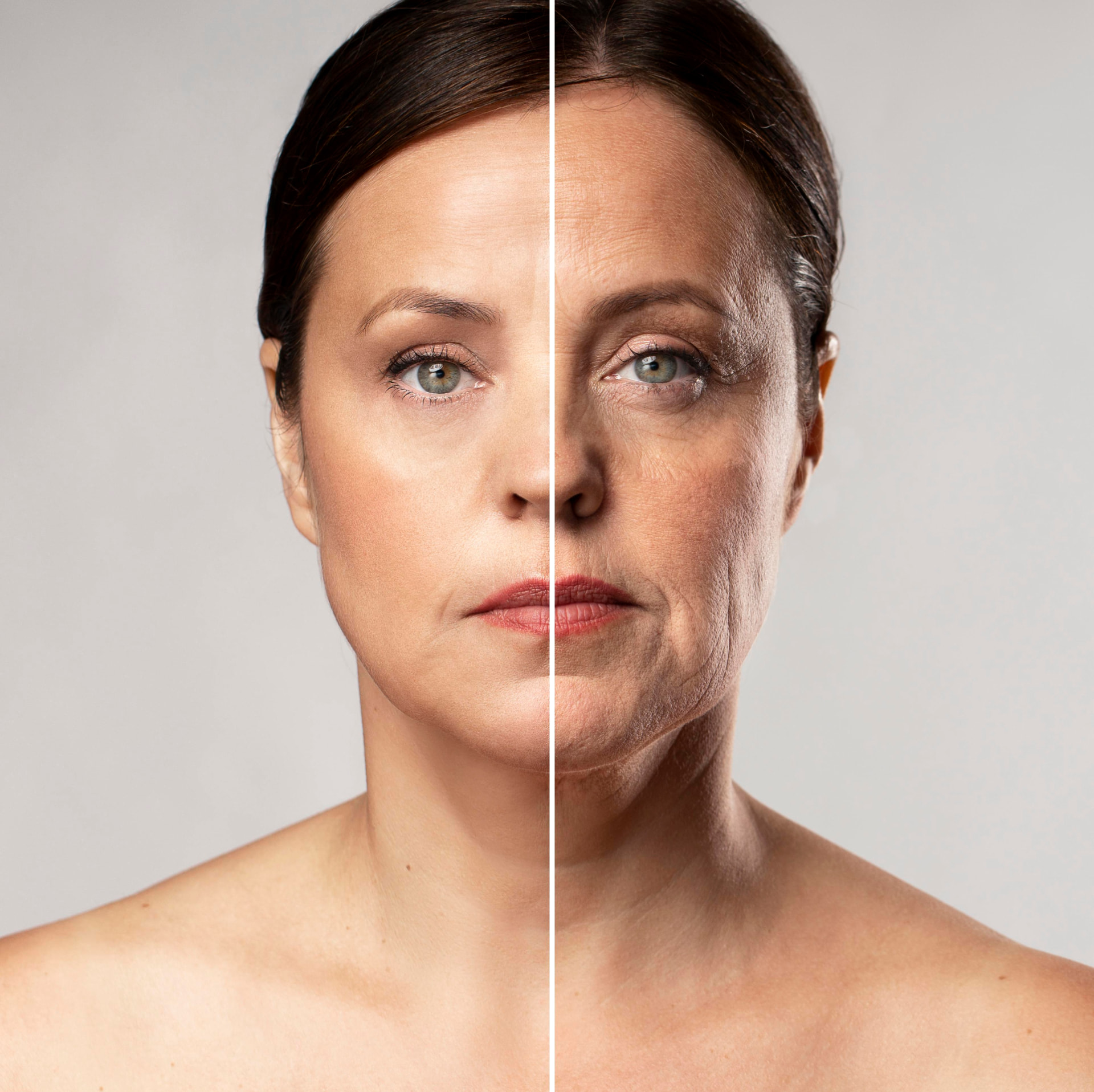 Bioestimulador de colágeno — Andréia Gomes, biomedicina estética